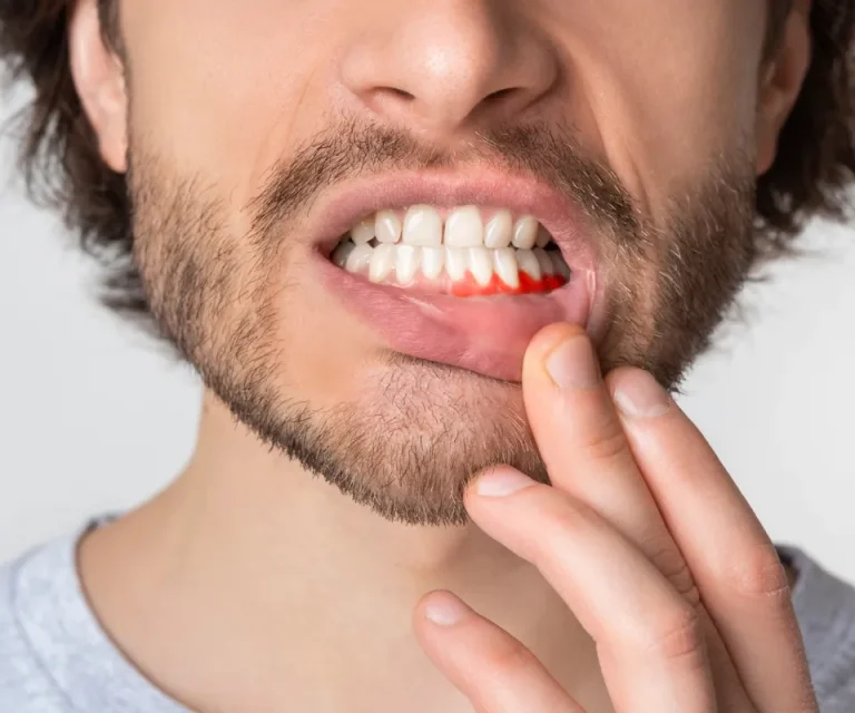 What is Emergency Tooth Infection Treatment